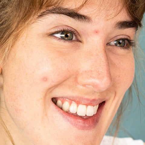 FaceTory | Spot Fighter PM Pimple Patches